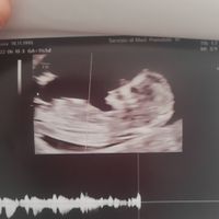 Future mamme Dicembre 2022 - 1