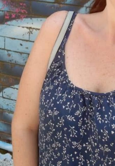 Braccia grosse e abito senza maniche: che ansia! - 2