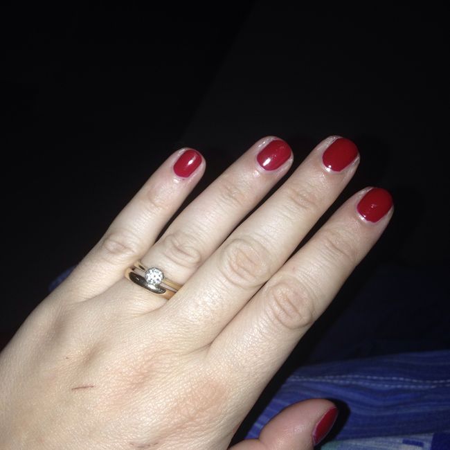 Anello ? Cosa vi ha regalato il vostro amore ? - 2