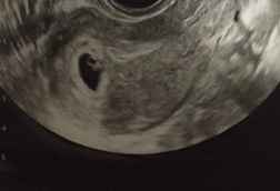 Metodo Ramzi! Chi ci sa azzeccare? 9