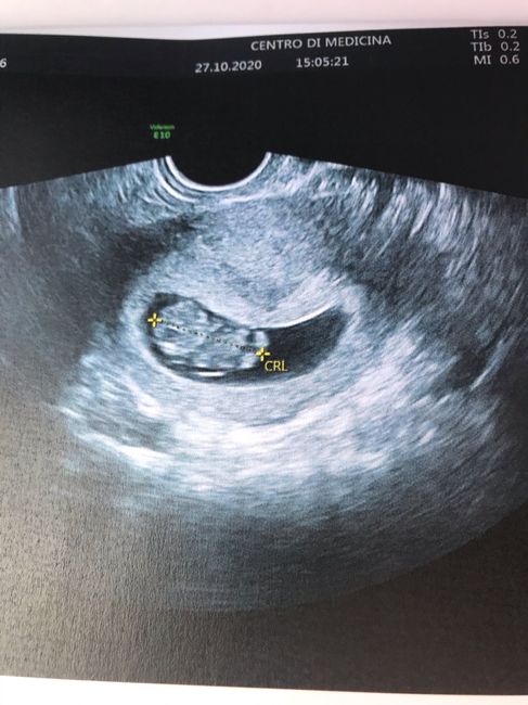 Future Mamme Maggio 2021❤️ - 1