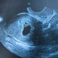 Future Mamme Maggio 2021❤️ - 1