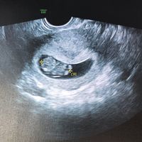 Future Mamme Maggio 2021❤️ - 1