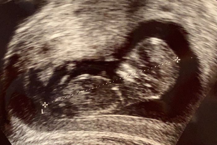 Future mamme Dicembre 2021 🎄🎁💙🎀 - 1