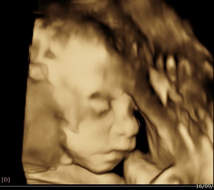 Future mamme Dicembre 2021 🎄🎁💙🎀 - 3