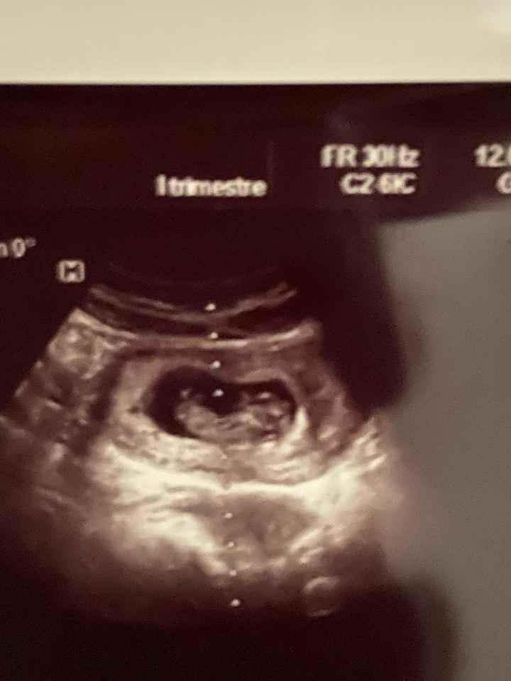 Qualcuno mi può aiutare secondo la teoria nub se sembra una femmina o un maschio... - 1