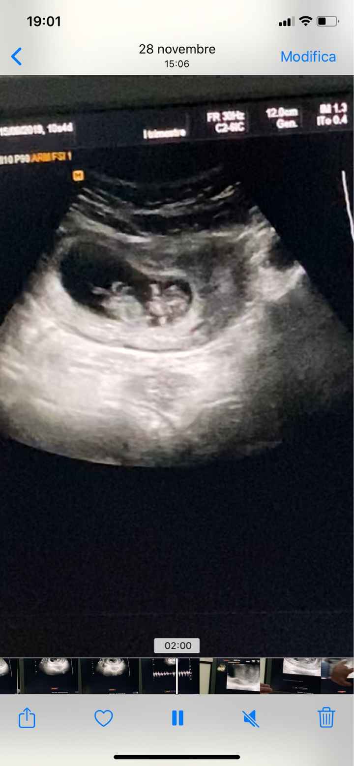 Fiocco rosa o azzurro?? 🙈 - 1