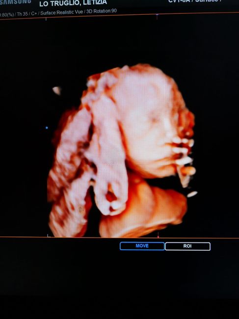 Mamme di Agosto 2020😍🤞😍 - 2