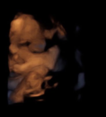 Mamme di Agosto 2020😍🤞😍 1