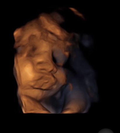Mamme di Agosto 2020😍🤞😍 2