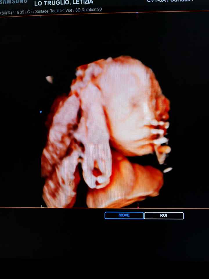 Mamme di Agosto 2020😍🤞😍 - 2