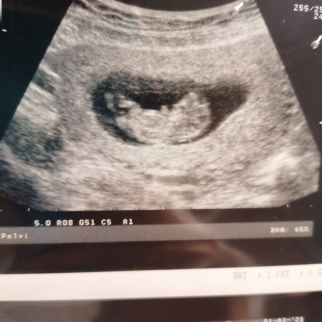Future Mamme Settembre 2021😍 - 1