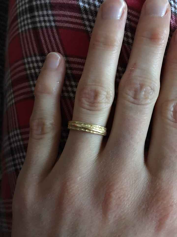  Fedi "zigrinate" - 1