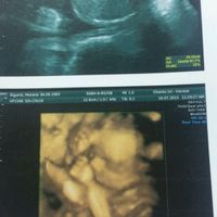 Mammine di novembre 2015 - 1