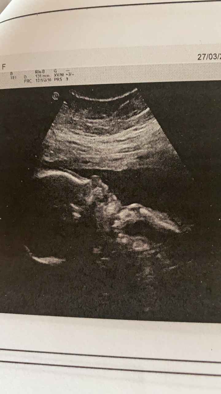 Mamme di Agosto 2020😍🤞😍 - 1