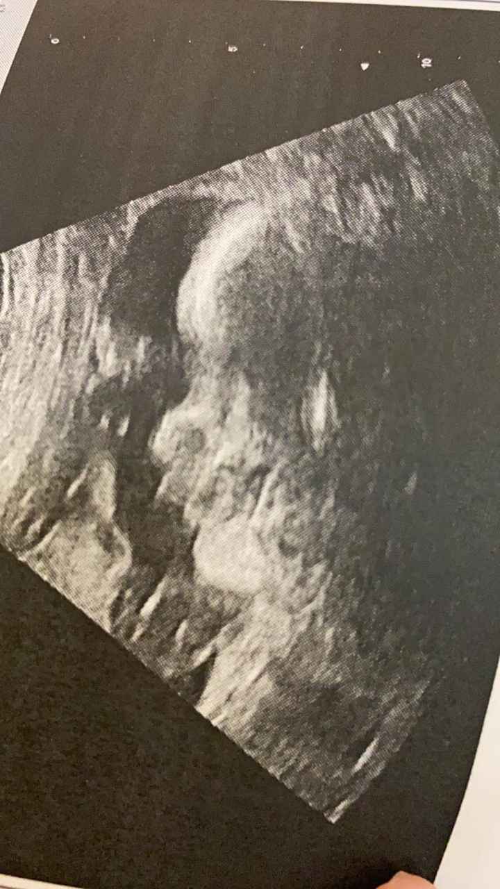 Mamme di Agosto 2020😍🤞😍 - 1