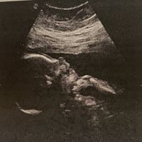 Mamme di Agosto 2020😍🤞😍 - 1