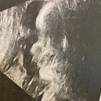 Mamme di Agosto 2020😍🤞😍 - 1