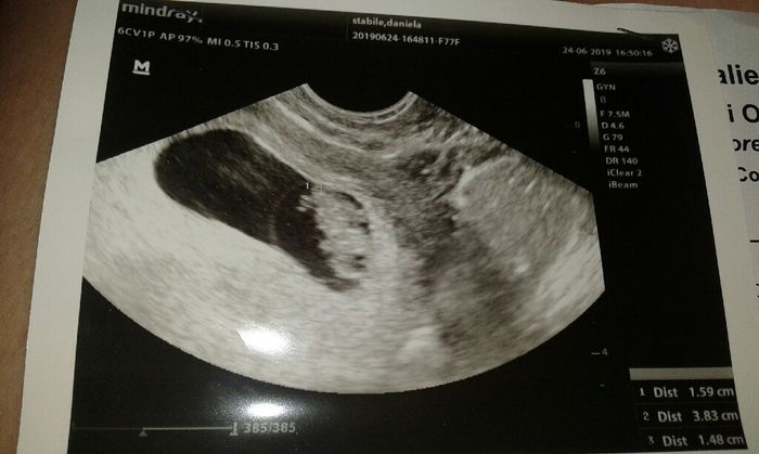 Metodo Ramzi cosa pensano le più esperte? 4