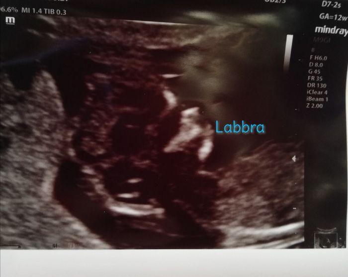 Future Mamme Febbraio 2021 1