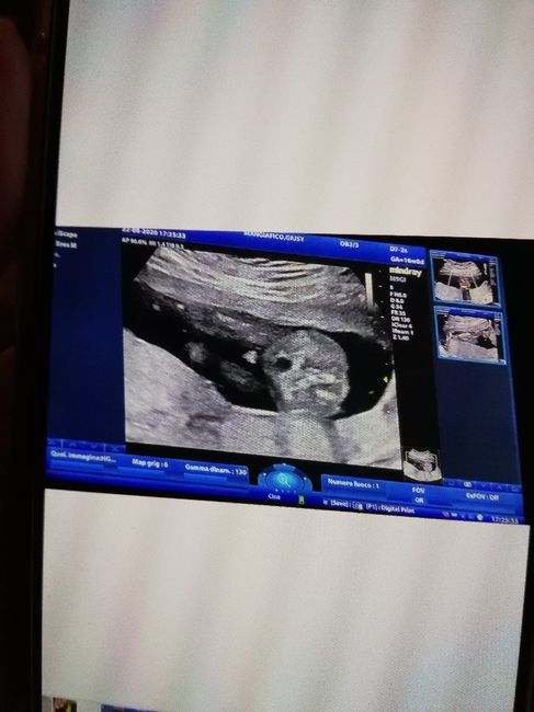 Future Mamme Febbraio 2021 4