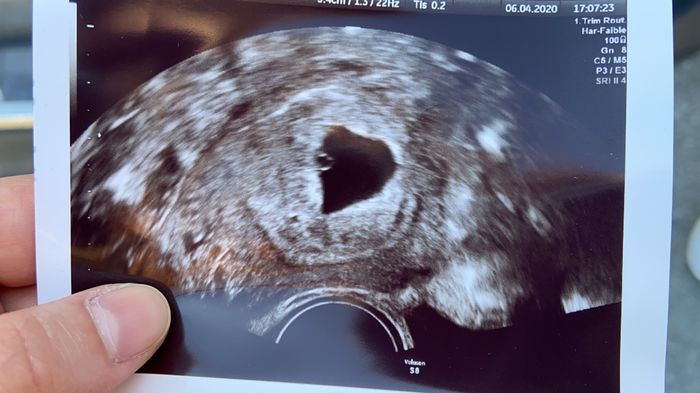 Future mamme novembre 2020 🌞🍁🌷♾ - 1