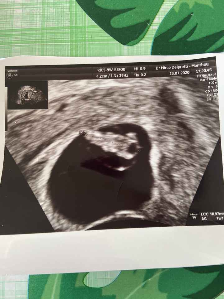 Future mamme Marzo 2021 - 1