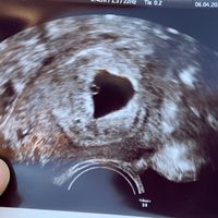 Future mamme novembre 2020 🌞🍁🌷♾ - 1