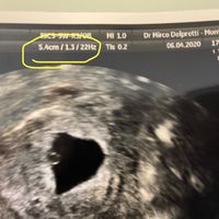 Future mamme novembre 2020 🌞🍁🌷♾ - 1