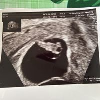 Future mamme Marzo 2021 - 1