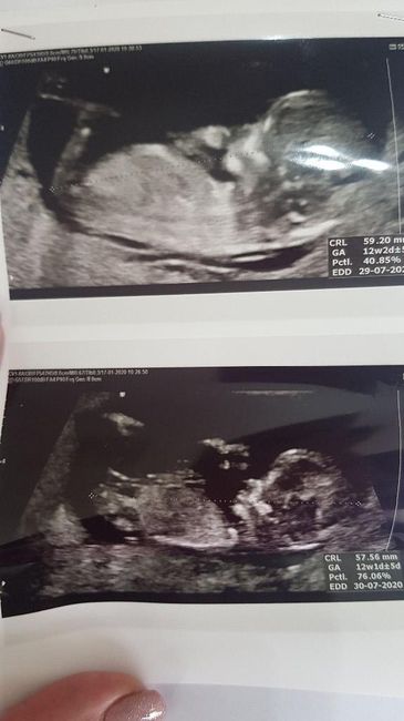 Esperte Nub Theory - 1