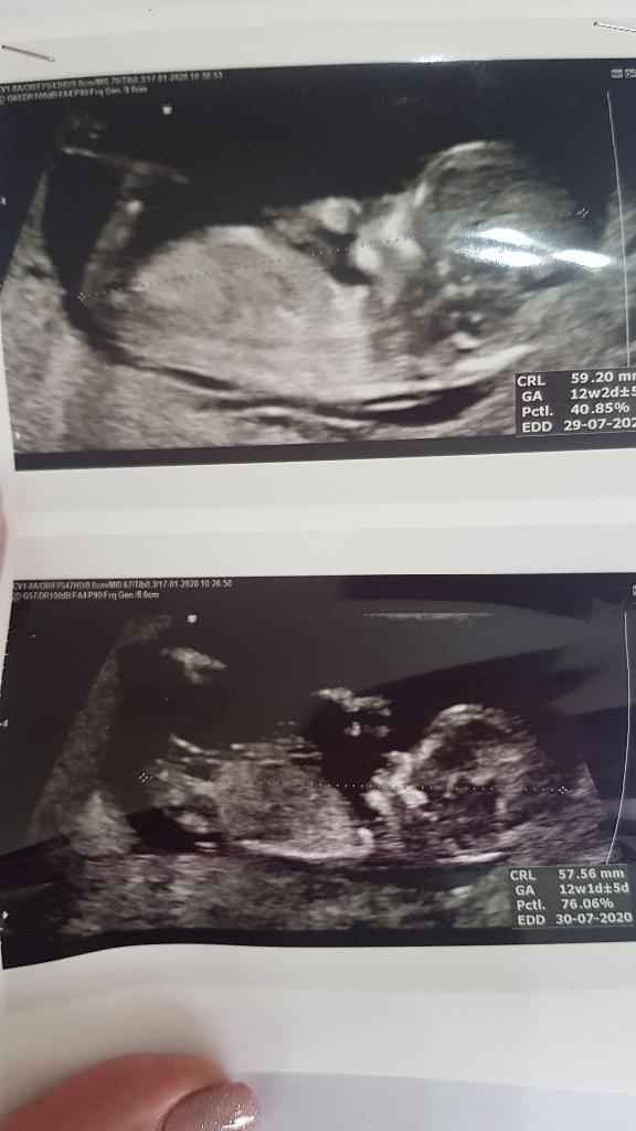 Esperte Nub Theory - 1