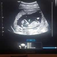 Esperte Nub Theory - 1