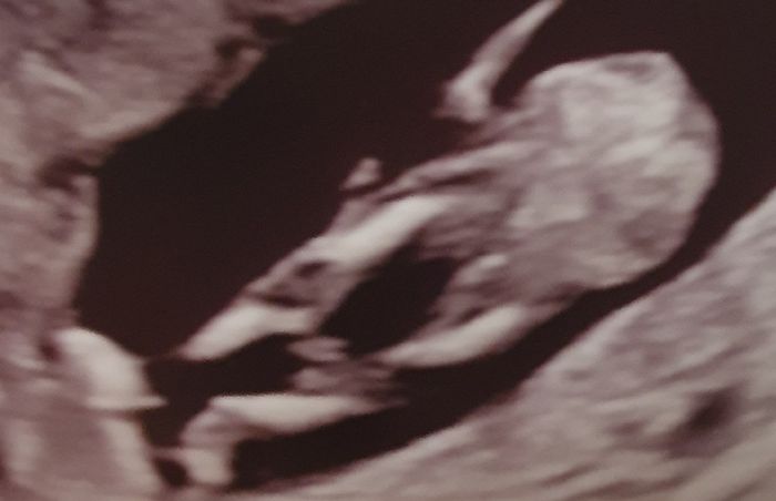 Future mamme di Aprile 2021 🐣 1