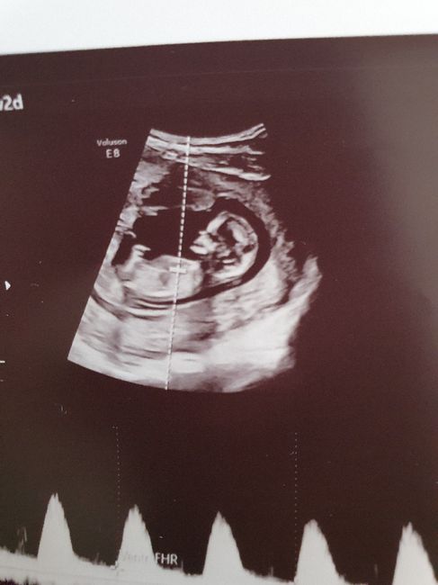 Future mamme di Aprile 2021 🐣 2