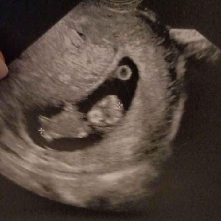 Future Mamme Settembre 2021😍 - 1