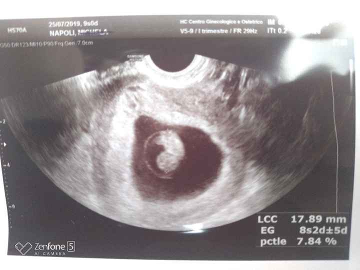 Future mamme maggio 2020 - 1