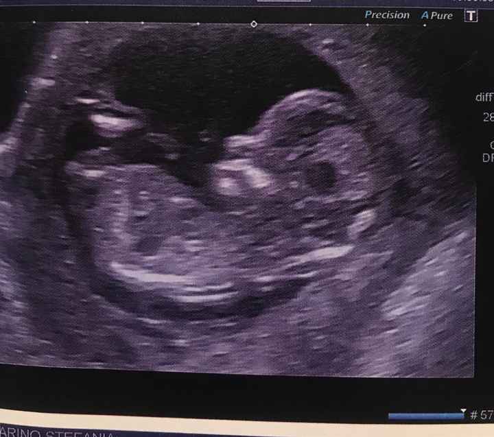 Esperte di Nub Theory a me 13