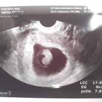 Future mamme maggio 2020 - 1