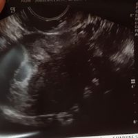 Future mamme di Aprile 2021 🐣 - 1