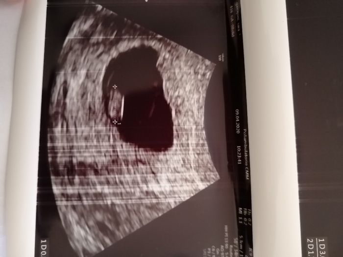 Future mamme ottobre 2020 4