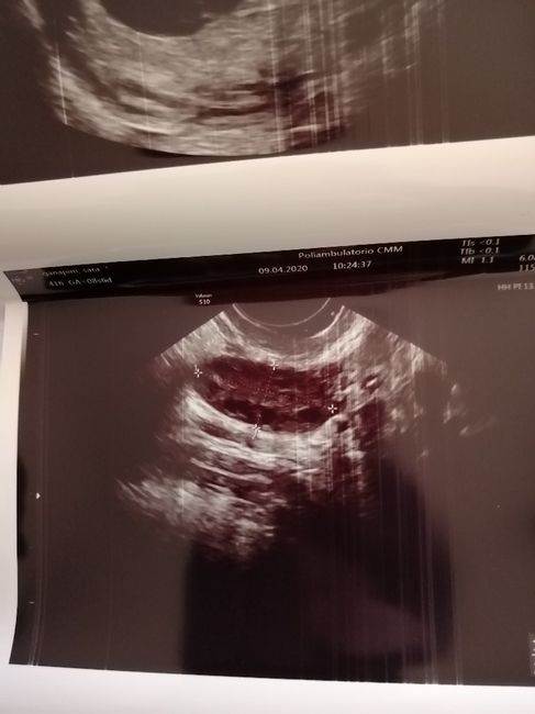 Future mamme ottobre 2020 3
