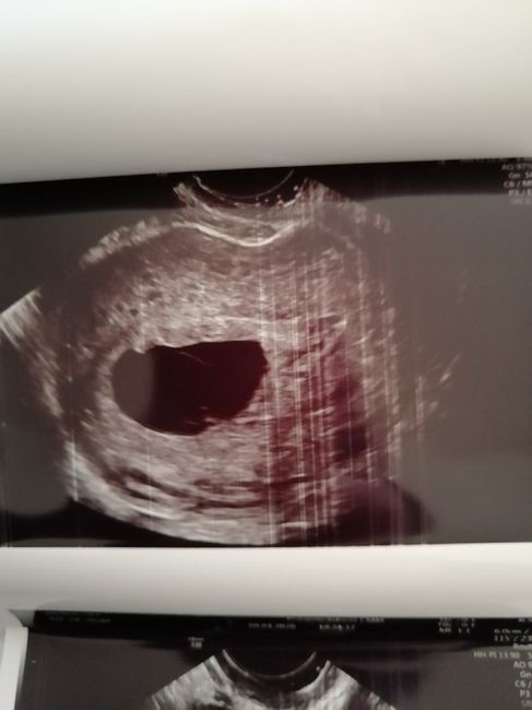 Future mamme ottobre 2020 1