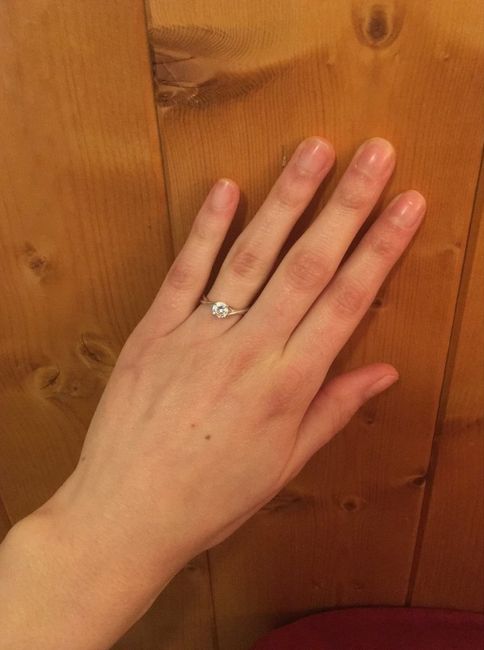 Il mio anello - 2