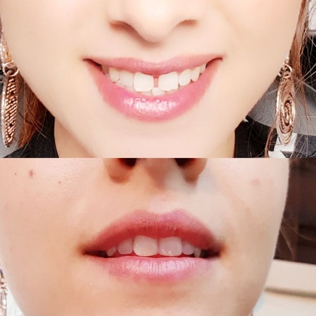 Un sogno che diventa realtà!! - 1