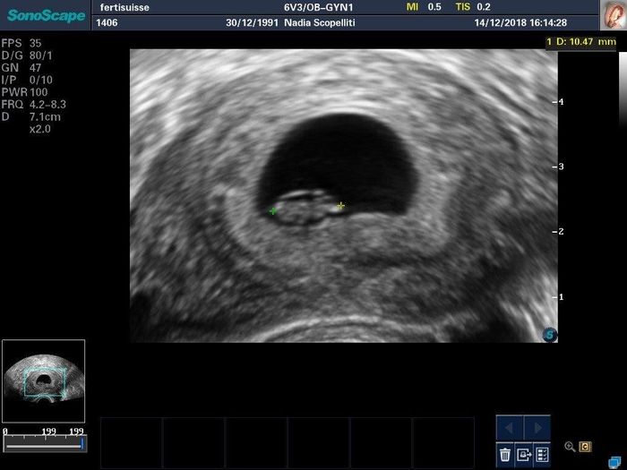 Due domandine 😜 - 1