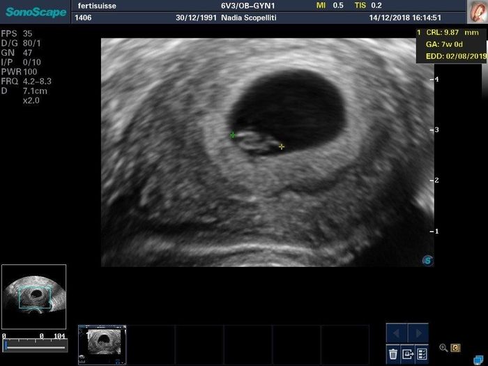 Due domandine 😜 - 2