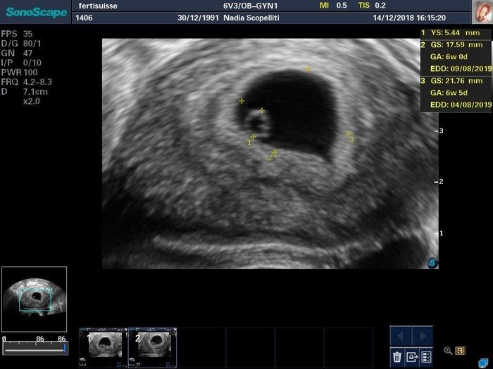 Due domandine 😜 - 3