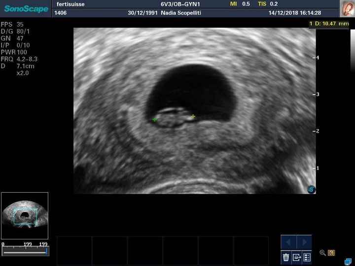 Due domandine 😜 - 1