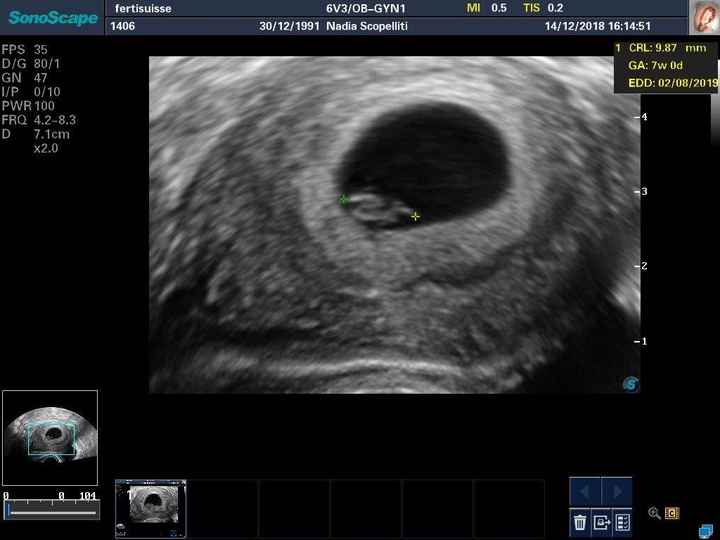 Due domandine 😜 - 2